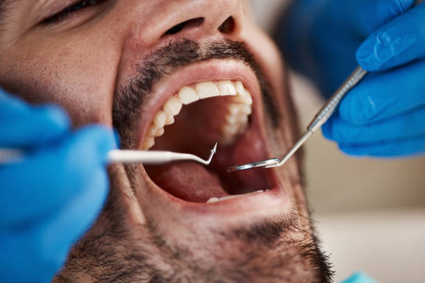 Dental X-Rays and Imaging in Clarkson Valley, MO